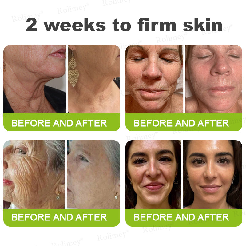 𝐑𝐨𝐥𝐢𝐦𝐞𝐲® 🧑‍⚕️ 𝐁𝐨𝐭𝐨𝐱-𝐋𝐢𝐤𝐞 𝐏𝐞𝐩𝐭𝐢𝐝𝐞𝐬 + 𝐕𝐢𝐭𝐚-𝐀 𝐑𝐞𝐭𝐢𝐧𝐨𝐥 𝐒𝐡𝐨𝐭 – 𝐖𝐫𝐢𝐧𝐤𝐥𝐞-𝐖𝐫𝐢𝐧𝐤𝐥𝐞-𝐋𝐢𝐟𝐭 𝐓𝐢𝐠𝐡𝐭𝐞𝐧𝐢𝐧𝐠 𝐬𝐭𝐢𝐜𝐤