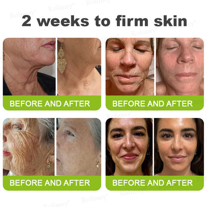 𝐑𝐨𝐥𝐢𝐦𝐞𝐲® 🧑‍⚕️ 𝐁𝐨𝐭𝐨𝐱-𝐋𝐢𝐤𝐞 𝐏𝐞𝐩𝐭𝐢𝐝𝐞𝐬 + 𝐕𝐢𝐭𝐚-𝐀 𝐑𝐞𝐭𝐢𝐧𝐨𝐥 𝐒𝐡𝐨𝐭 – 𝐖𝐫𝐢𝐧𝐤𝐥𝐞-𝐖𝐫𝐢𝐧𝐤𝐥𝐞-𝐋𝐢𝐟𝐭 𝐓𝐢𝐠𝐡𝐭𝐞𝐧𝐢𝐧𝐠 𝐬𝐭𝐢𝐜𝐤
