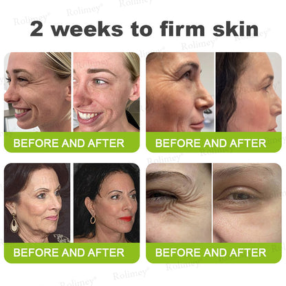 𝐑𝐨𝐥𝐢𝐦𝐞𝐲® 🧑‍⚕️ 𝐁𝐨𝐭𝐨𝐱-𝐋𝐢𝐤𝐞 𝐏𝐞𝐩𝐭𝐢𝐝𝐞𝐬 + 𝐕𝐢𝐭𝐚-𝐀 𝐑𝐞𝐭𝐢𝐧𝐨𝐥 𝐒𝐡𝐨𝐭 – 𝐖𝐫𝐢𝐧𝐤𝐥𝐞-𝐖𝐫𝐢𝐧𝐤𝐥𝐞-𝐋𝐢𝐟𝐭 𝐓𝐢𝐠𝐡𝐭𝐞𝐧𝐢𝐧𝐠 𝐬𝐭𝐢𝐜𝐤