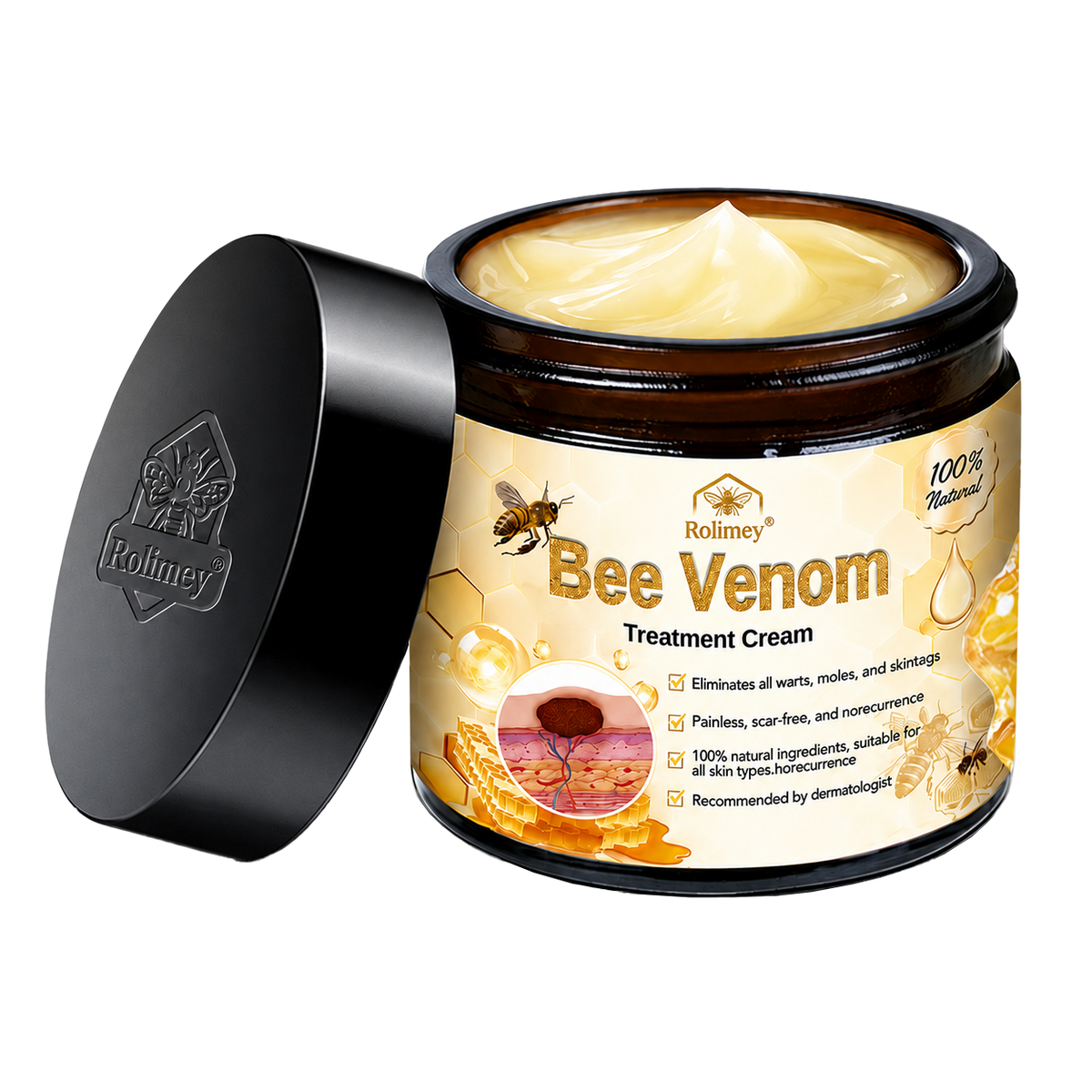 ✅✅Rolimey® Bee Venom Skin Treatment Cream - (Helping with acne, rosacea, psoriasis, age spots, eczema, and reducing the appearance of stretch marks)
