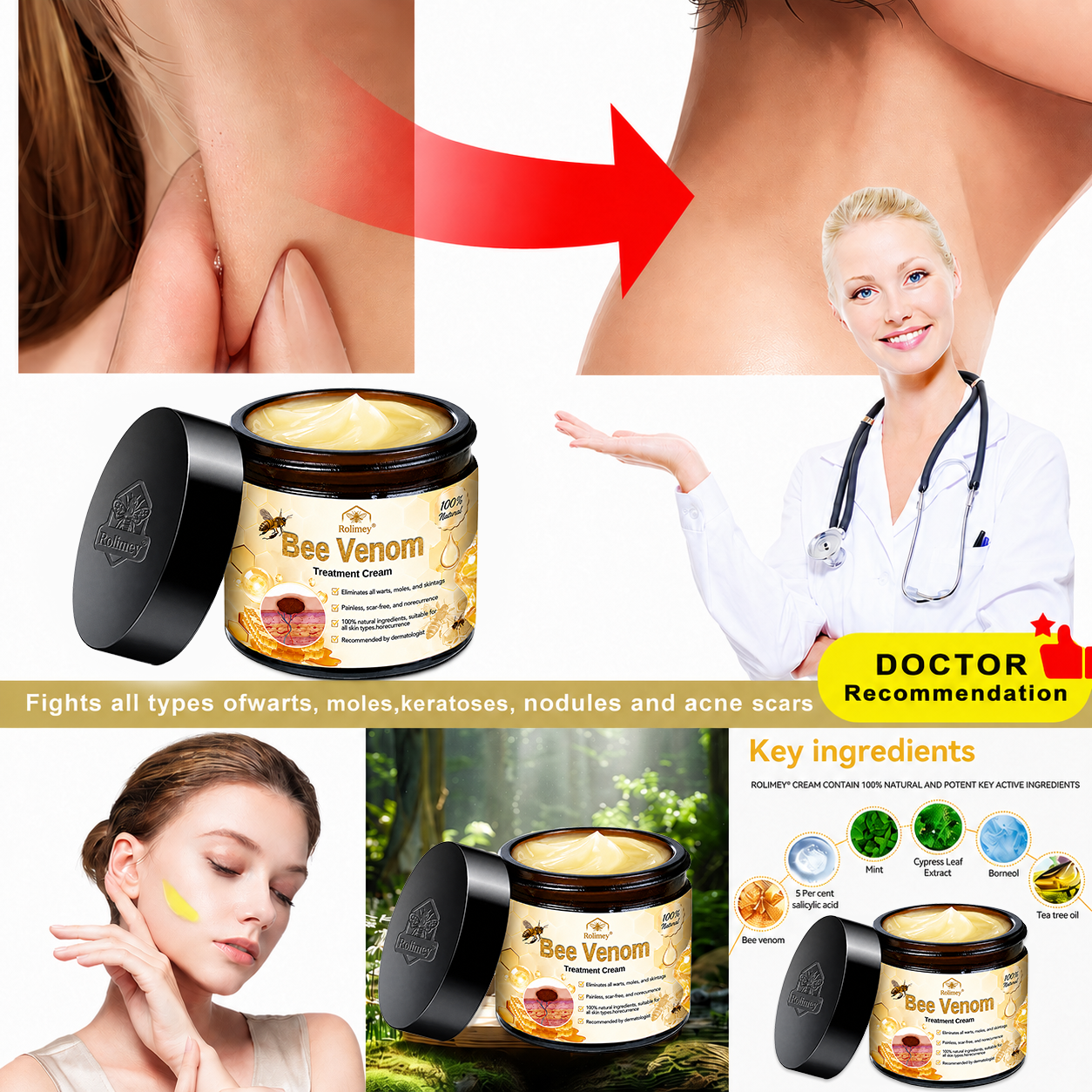🔥Rolimey® Bee Venom Skin Treatment Cream