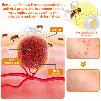 🌿Rolimey® Bee Venom Skin Treatment Cream - (Helping with acne, wart, rosacea, psoriasis, age spots, eczema, and reducing the appearance of stretch marks)