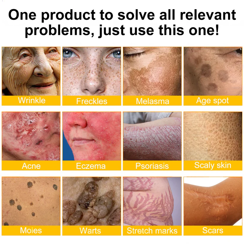 🌟👨‍⚕️ Rolimey® Bee venom Pro Comprehensive Cream —Tightening for Skin Types 🔥