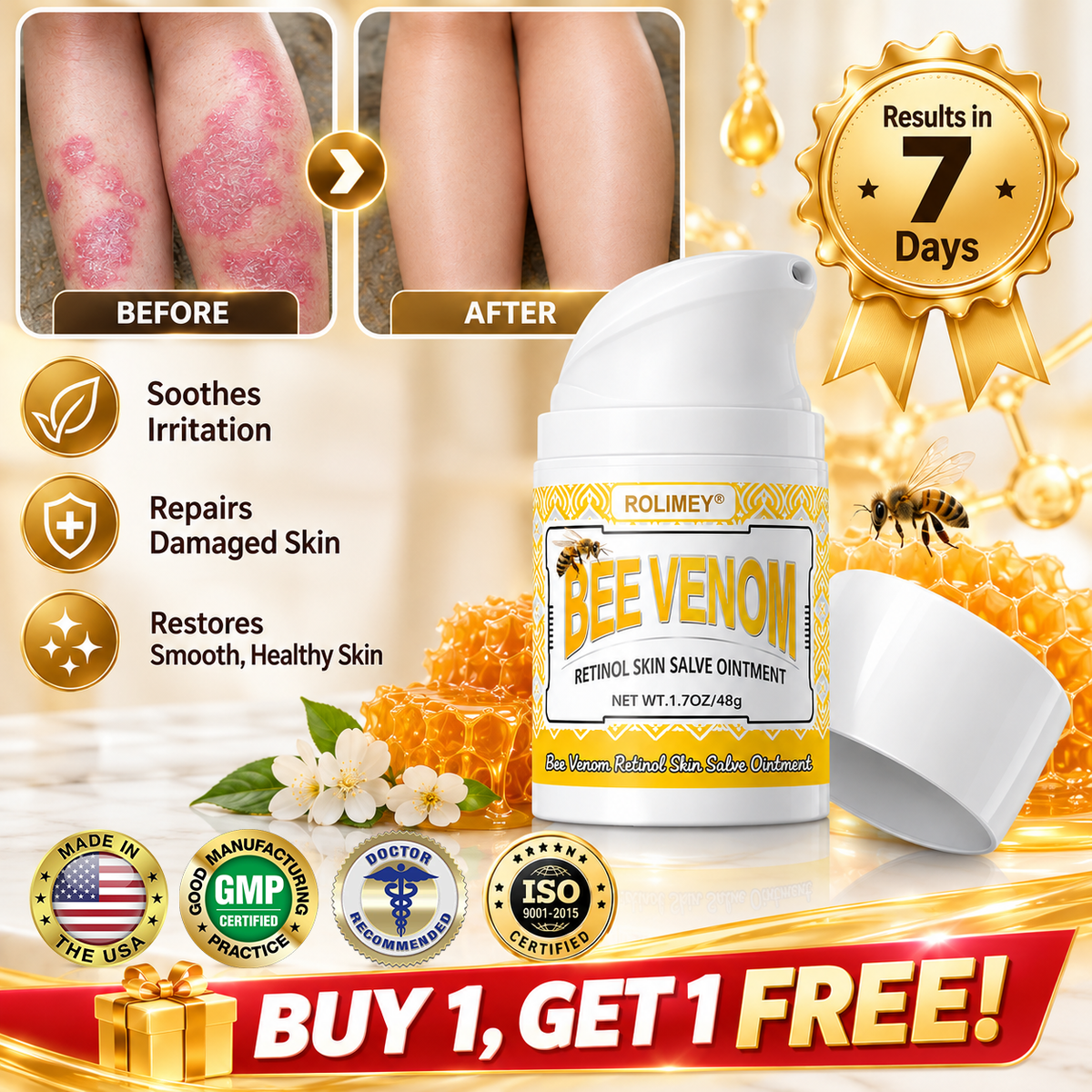 [Official Brand Store]🐝Rolimey® Bee Venom Retinol Skin Salve Ointment