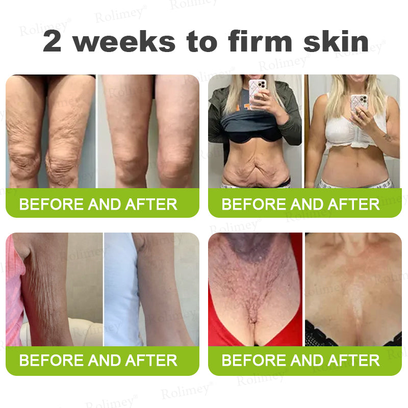 𝐑𝐨𝐥𝐢𝐦𝐞𝐲® 🧑‍⚕️ 𝐁𝐨𝐭𝐨𝐱-𝐋𝐢𝐤𝐞 𝐏𝐞𝐩𝐭𝐢𝐝𝐞𝐬 + 𝐕𝐢𝐭𝐚-𝐀 𝐑𝐞𝐭𝐢𝐧𝐨𝐥 𝐒𝐡𝐨𝐭 – 𝐖𝐫𝐢𝐧𝐤𝐥𝐞-𝐖𝐫𝐢𝐧𝐤𝐥𝐞-𝐋𝐢𝐟𝐭 𝐓𝐢𝐠𝐡𝐭𝐞𝐧𝐢𝐧𝐠 𝐬𝐭𝐢𝐜𝐤