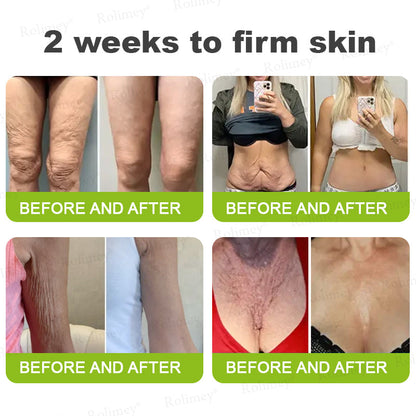 𝐑𝐨𝐥𝐢𝐦𝐞𝐲® 🧑‍⚕️ 𝐁𝐨𝐭𝐨𝐱-𝐋𝐢𝐤𝐞 𝐏𝐞𝐩𝐭𝐢𝐝𝐞𝐬 + 𝐕𝐢𝐭𝐚-𝐀 𝐑𝐞𝐭𝐢𝐧𝐨𝐥 𝐒𝐡𝐨𝐭 – 𝐖𝐫𝐢𝐧𝐤𝐥𝐞-𝐖𝐫𝐢𝐧𝐤𝐥𝐞-𝐋𝐢𝐟𝐭 𝐓𝐢𝐠𝐡𝐭𝐞𝐧𝐢𝐧𝐠 𝐬𝐭𝐢𝐜𝐤