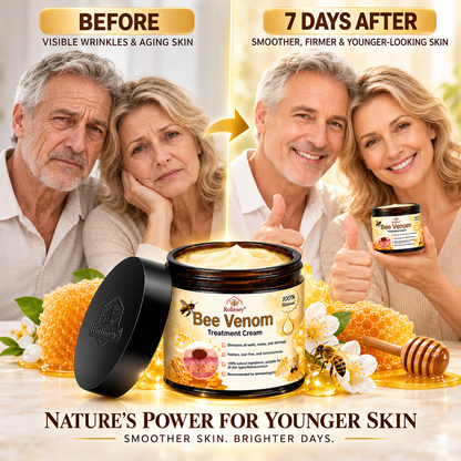 ✅✅Rolimey® Bee Venom Skin Treatment Cream - (Helping with acne, rosacea, psoriasis, age spots, eczema, and reducing the appearance of stretch marks)