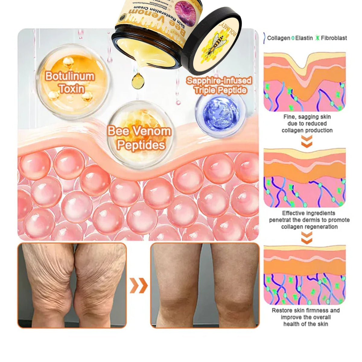 🌟Official Brand Shop丨Rolimey® 🐝Bee venom Pro Comprehensive Cream—Tightening for Skin Types
