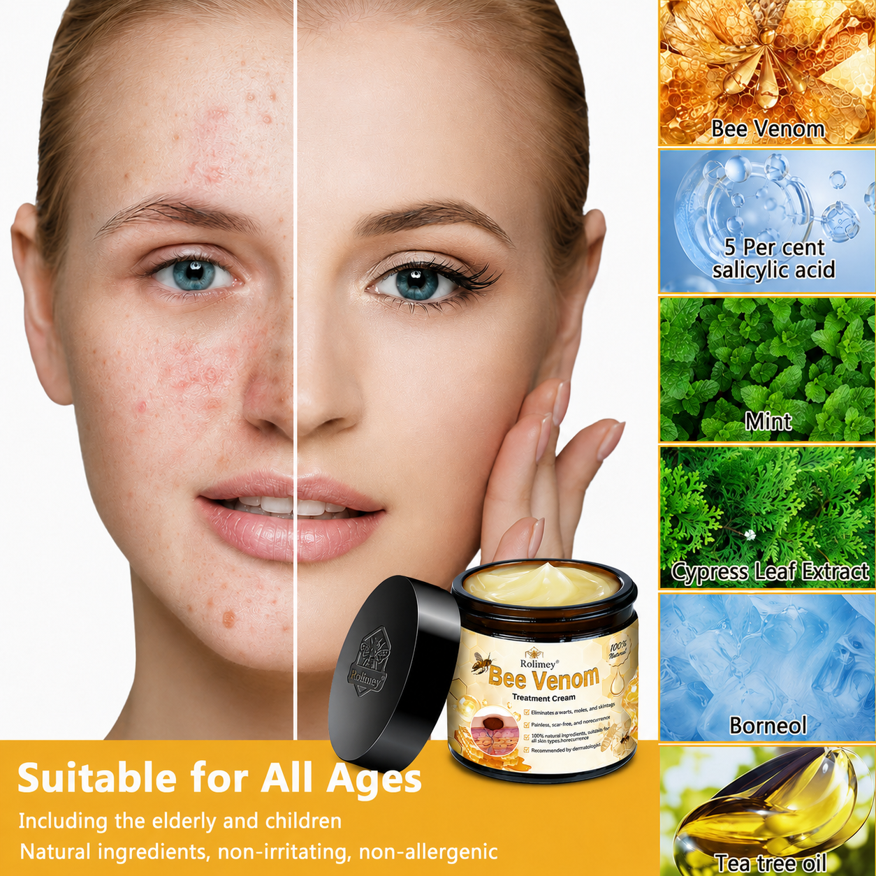 🔥Rolimey® Bee Venom Skin Treatment Cream
