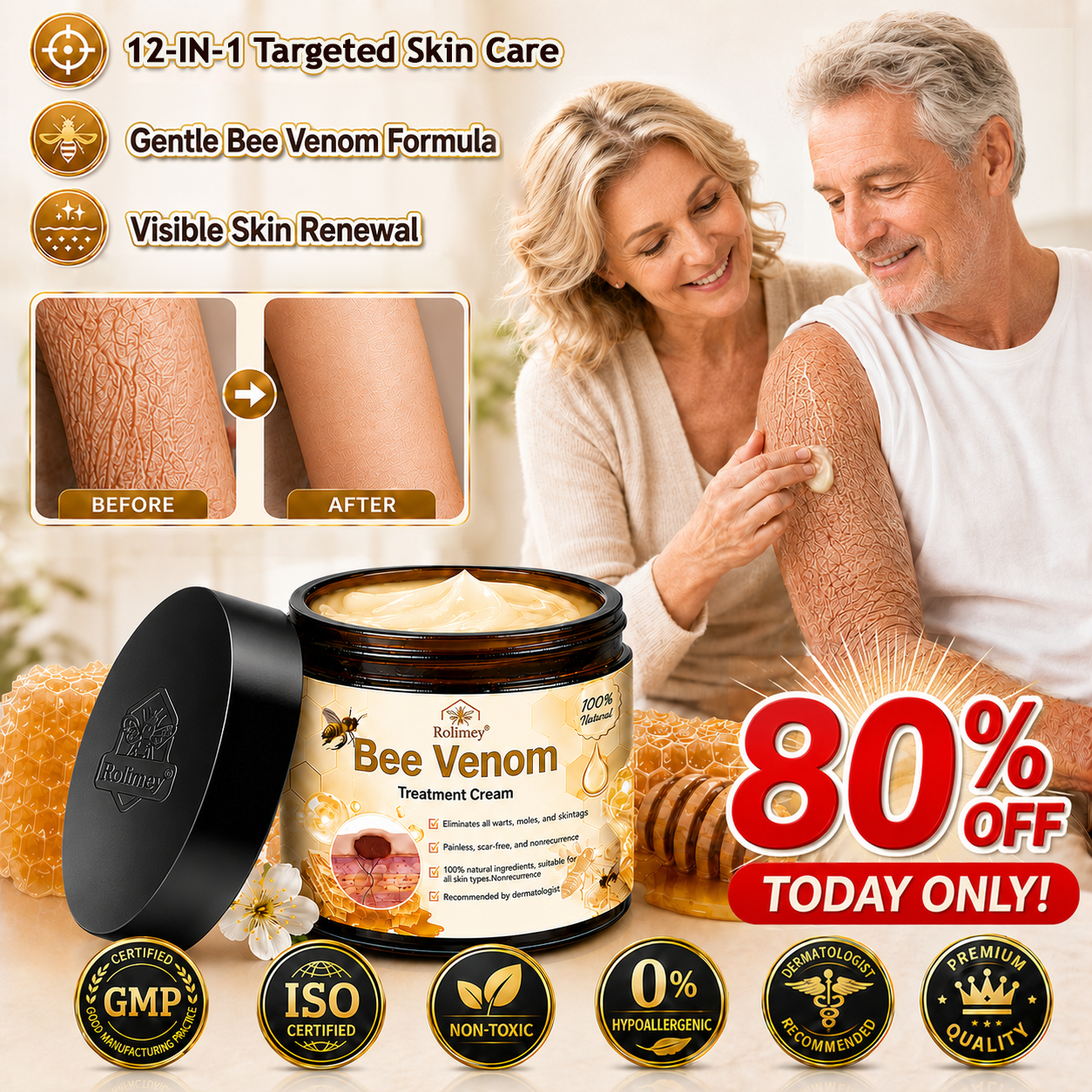 ✅✅Rolimey® Bee Venom Skin Treatment Cream - (Helping with acne, rosacea, psoriasis, age spots, eczema, and reducing the appearance of stretch marks)