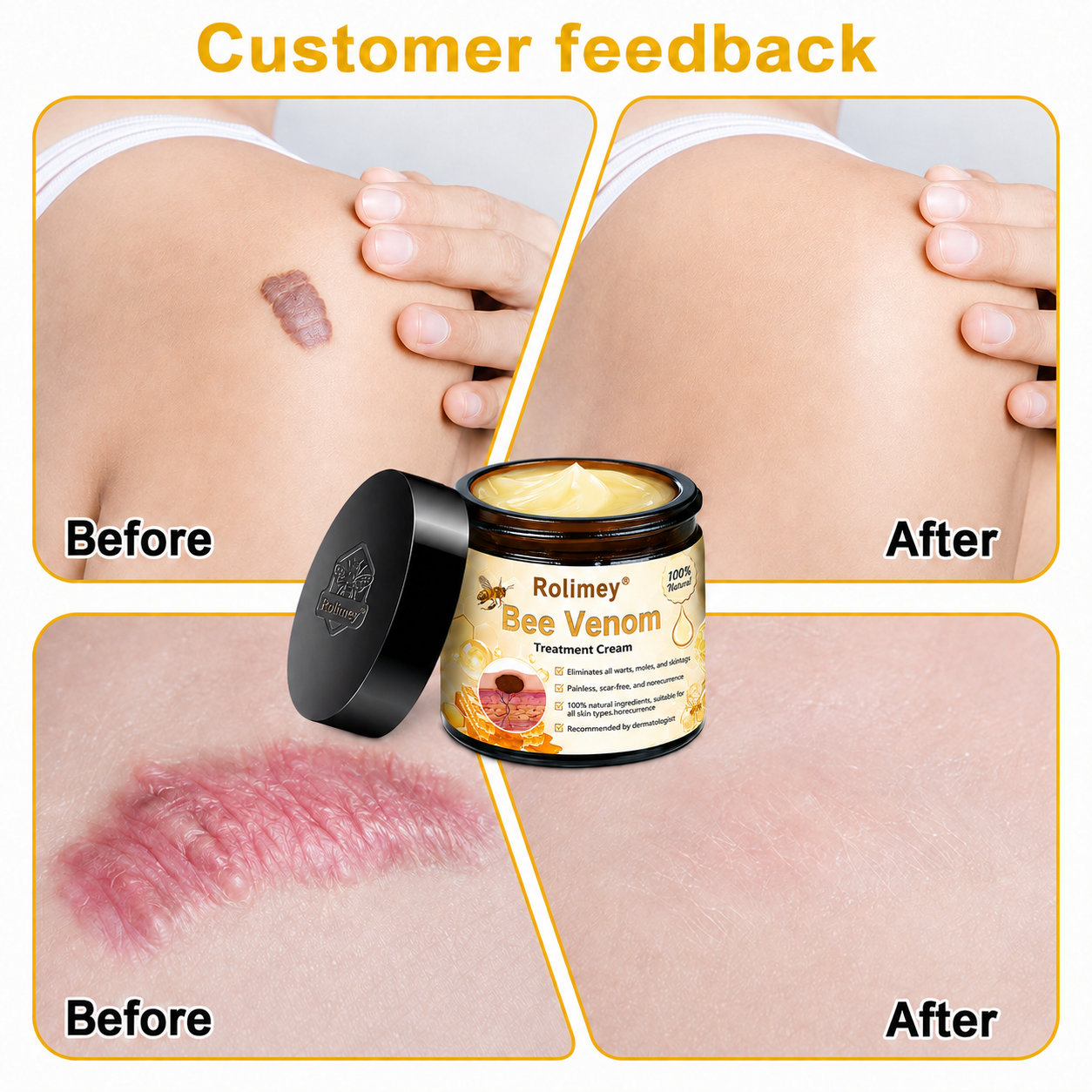 🔥Rolimey® Bee Venom Skin Treatment Cream