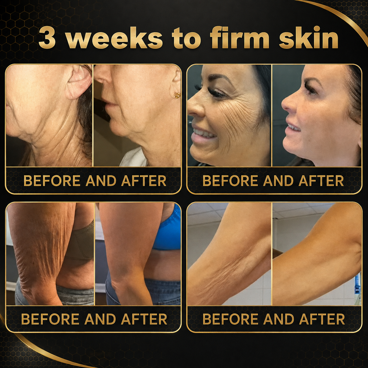 🧩Rolimey® Bee venom Pro Comprehensive Cream —Tightening for Skin Types 🔥