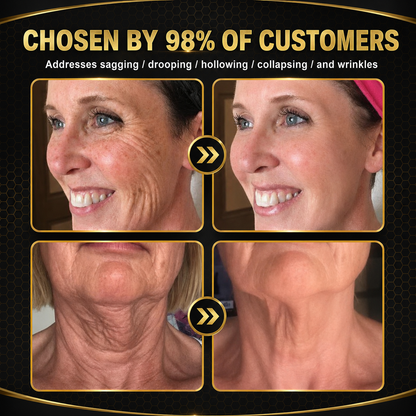 🧩Rolimey® Bee venom Pro Comprehensive Cream —Tightening for Skin Types 🔥