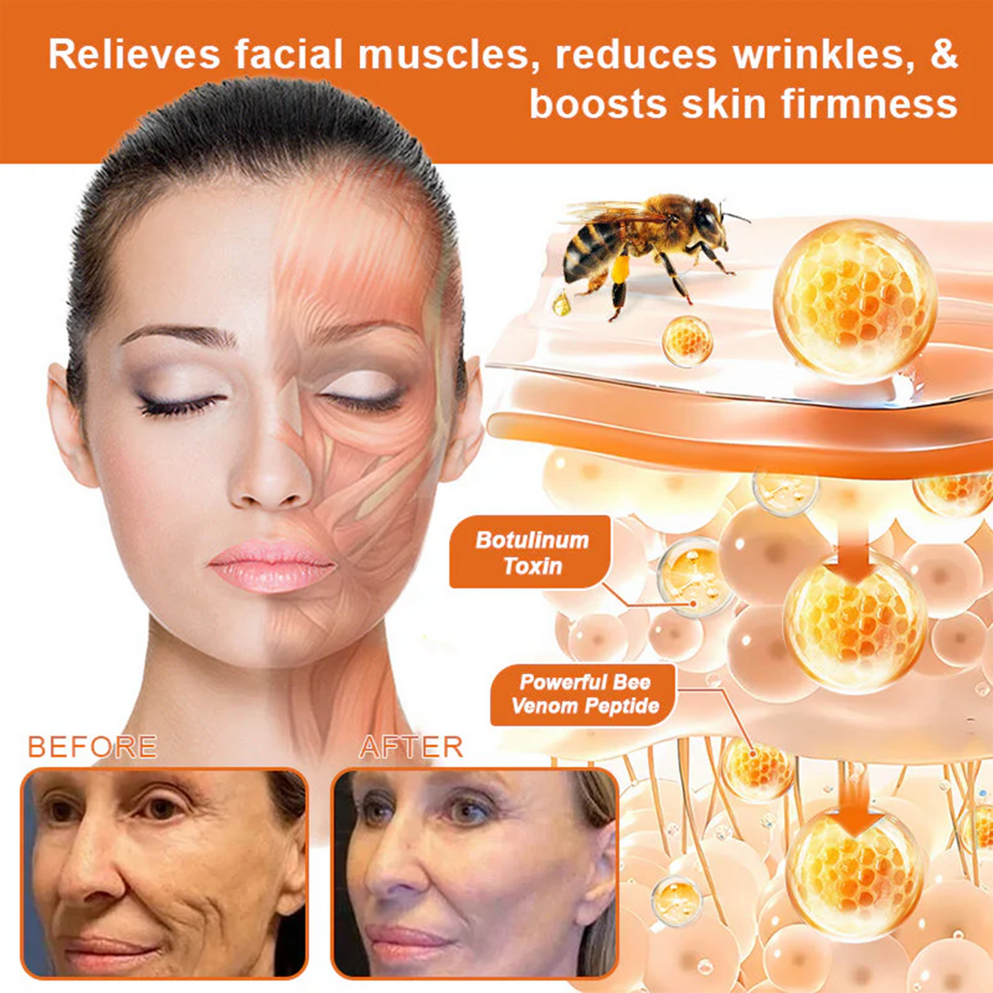 ✅✅Rolimey® Bee Venom Skin Treatment Cream - (Helping with acne, rosacea, psoriasis, age spots, eczema, and reducing the appearance of stretch marks)