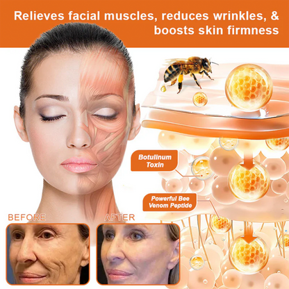 ✅✅Rolimey® Bee Venom Skin Treatment Cream - (Helping with acne, rosacea, psoriasis, age spots, eczema, and reducing the appearance of stretch marks)