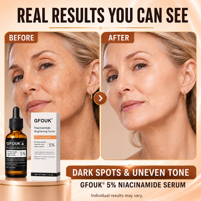 🔥 Over 100,000 units sold ❤️– GFOUK® Niacinamide Brightening Serum