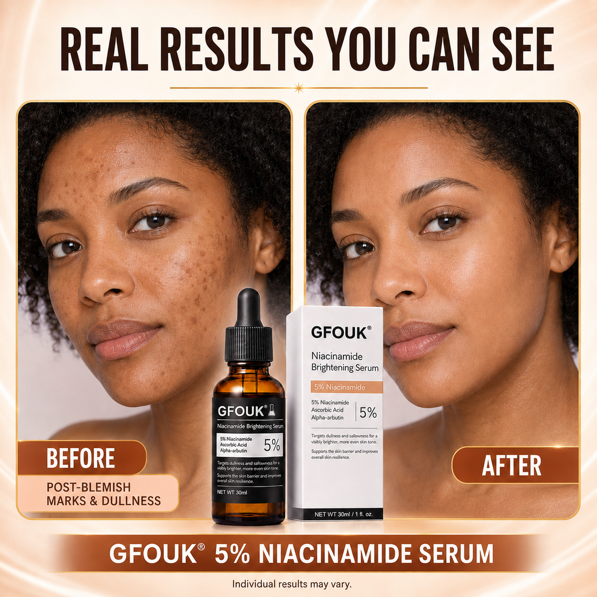 🔥 Over 100,000 units sold ❤️– GFOUK® Niacinamide Brightening Serum