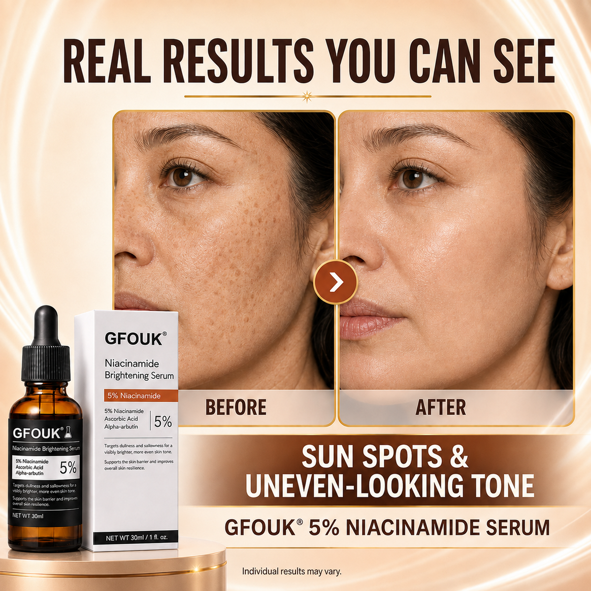 🔥 Over 100,000 units sold ❤️– GFOUK® Niacinamide Brightening Serum