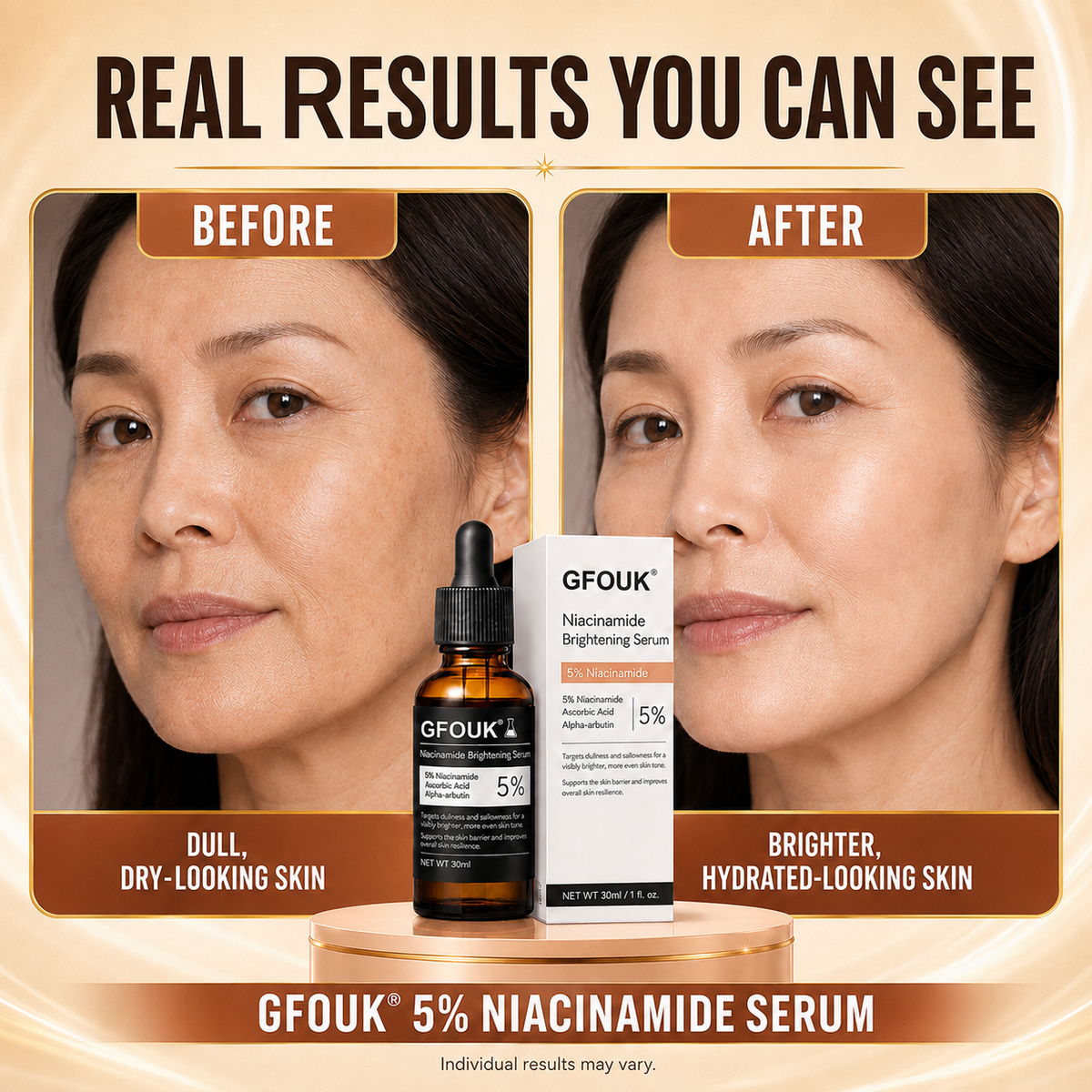 🔥 Over 100,000 units sold ❤️– GFOUK® Niacinamide Brightening Serum