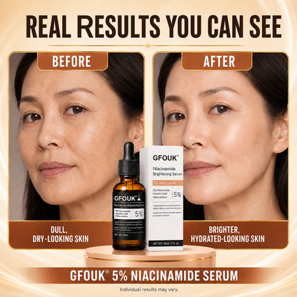 🔥 Over 100,000 units sold ❤️– GFOUK® Niacinamide Brightening Serum